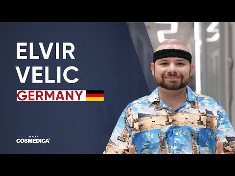 Elvir Velic Hair Transplant Review | Dr. Acar | Cosmedica Clinic