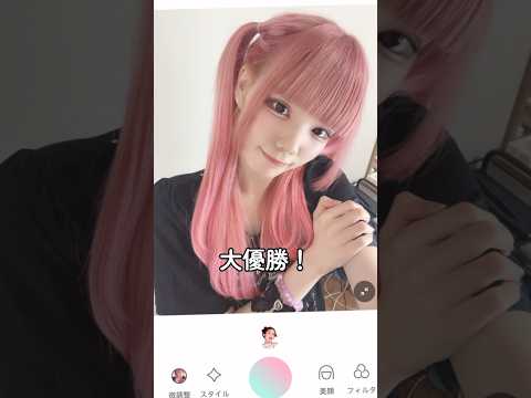 【二重整形】ダウンタイムから1ヶ月経った二重は… #shorts