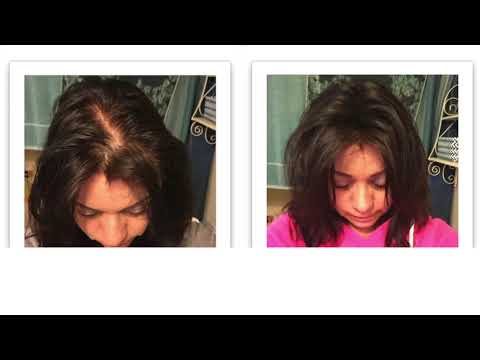 Caboki Hair Fiber - Caboki In Pakistan -  CABOKI