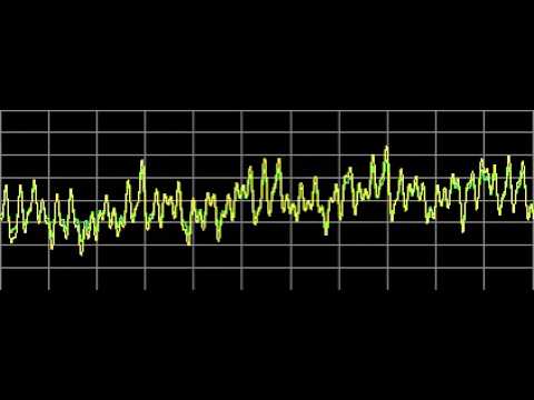 Heart Disease - Rife Frequencies