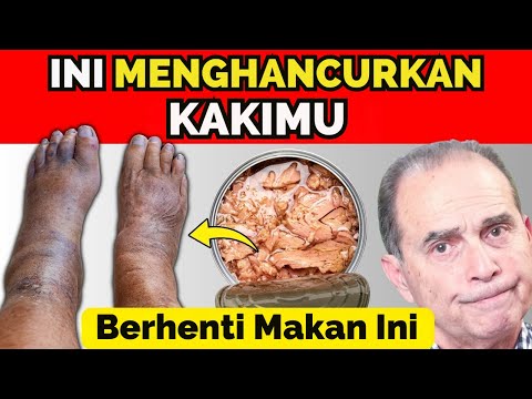 🔥 6 Makanan Ini Bisa Sebabkan Kesemutan & Kram Kaki! 🚨❌ Hati-Hati, Bisa Berbahaya! ⚠️🥖🍟