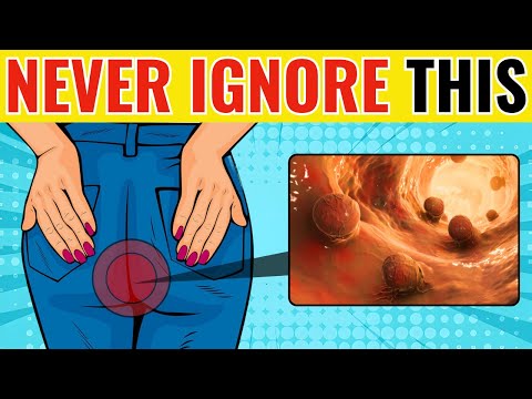 Bowel Cancer: Scary Symptoms That Require URGENT Investigation!