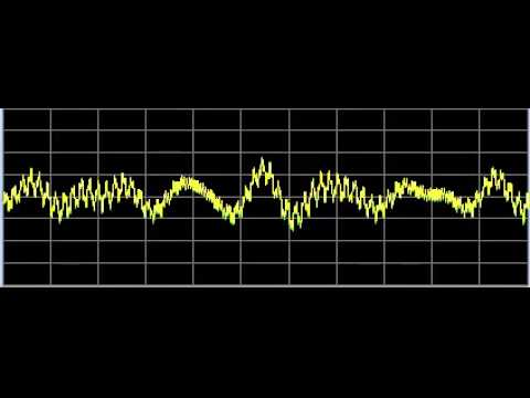 Sexual Dysfunction (Male and Female) - Rife Frequencies