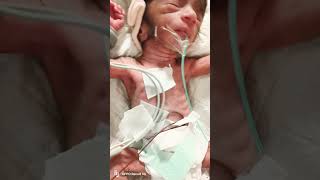 striving for life #life #nicubabies #babyshorts #likeandsubscribe  #blessings #nicujourney #babylove
