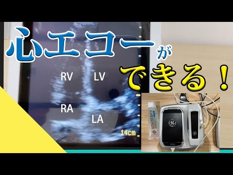 【心エコー教えます】実際の画面ではこう見える！