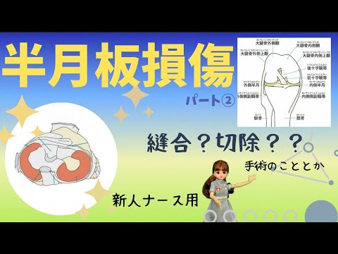 【半月板損傷②】半月板縫合術＆切除術を簡潔に学ぶ★#整形外科#看護師#勉強