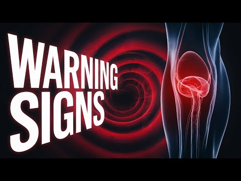 What Are The DANGEROUS Signs Of Blood Clots