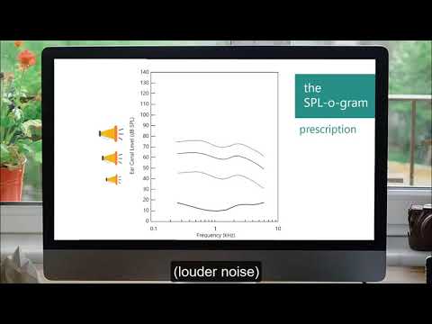 How Technology Helps for Moderate Hearing Loss (Captioned)