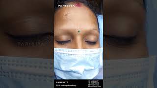 Eyebrow Microblading | Before & After Of Microblading