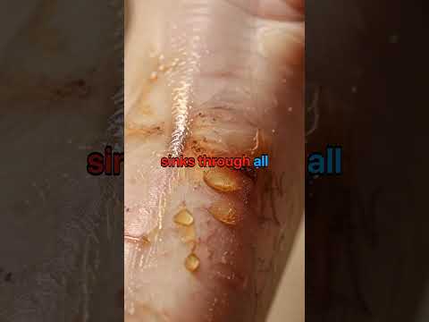The Castor Oil Secret Nobody Follows