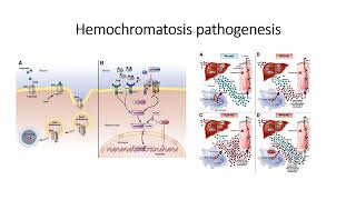 Hemochromatosis Pathogenesis: Genetic Mutation disease #Code: 206