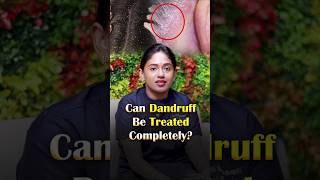 Can Dandruff Be Treated Completely? 🤔🧴#trending #shorts #dandruffcontrol#dandruff #haircare
