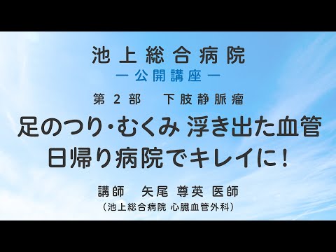 第2部 下肢静脈瘤〈池上総合病院 公開講座〉