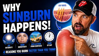 ☀️🔥 Why You Keep Getting Sunburned (It’s Not Heat) 