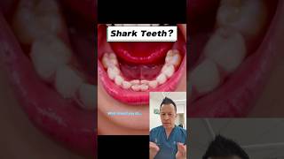 Dealing With Bottom Front Teeth Coming Out Crooked #shorts #dentalhealth #sharkteeth #dentist