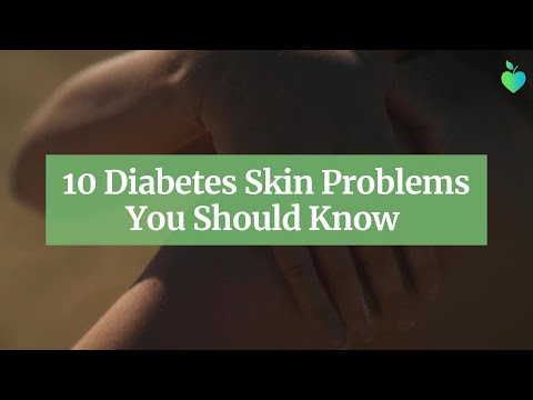 10 Diabetes Skin Problems You Should Know