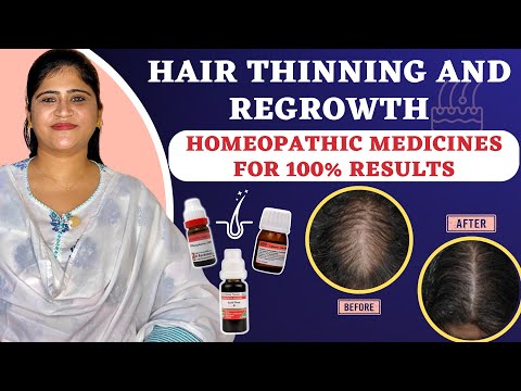 Hair Thinning & Hair Regrowth : Best Homeopathic medicines। बालों को बनाये घने और जड़ से मज़बूत ।