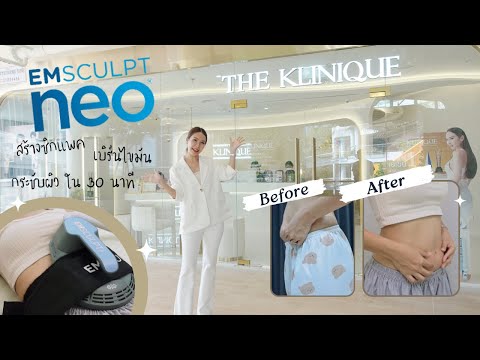 รีวิว สร้างซิกแพค เบิร์นไขมัน กระชับผิว ด้วยเครื่อง Emsculpt Neo ที่ THE KLINIQUE