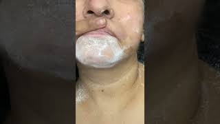 Upper lips #waxing#jasminebeautysalon
