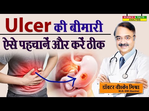 Ulcer की बीमारी ऐसे पहचानें और करें ठीक || STOMACH ULCERS