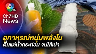 หนุ่มพลังใบแชร์ประสบการณ์ตรง ซดแต่น้ำกระท่อม ลำไส้อุดตันเฉียดตาย ต้องผ่าตัดด่วน !
