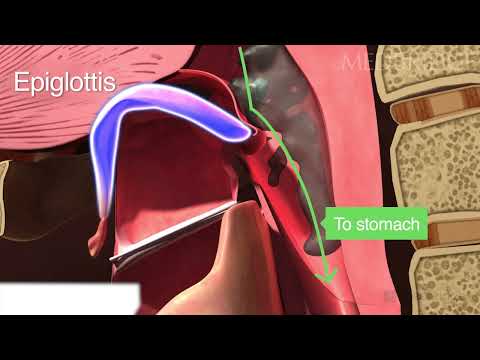 Aspiration During Swallow - Patient Education | Medbridge