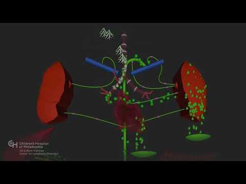 Multicompartment Lymphatic Failure