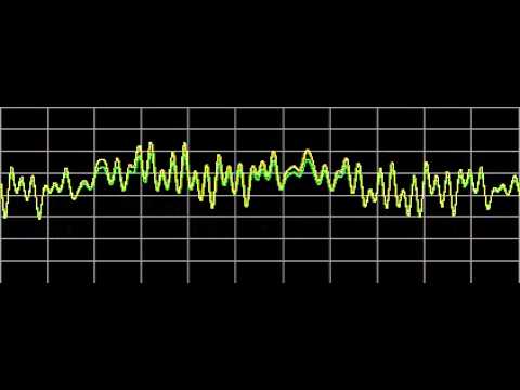 Glaucoma - Rife Frequencies