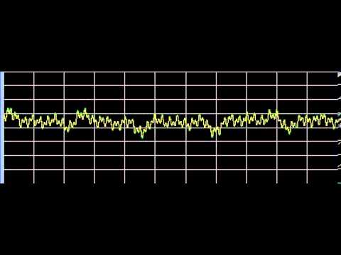 Urethral Stricture - Rife Frequencies