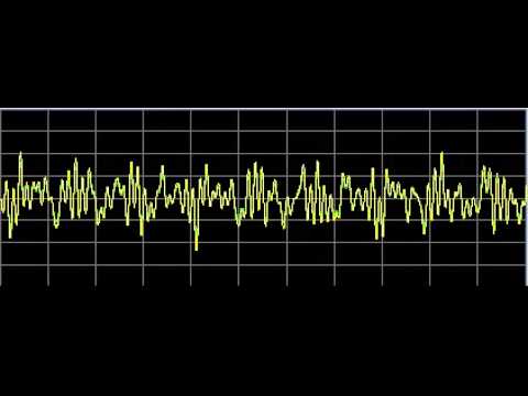 Ehlers-Danlos Syndrome - Rife Frequencies