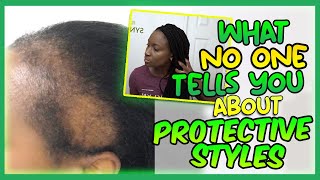 What NO ONE tells you about PROTECTIVE STYLES #shorts #braids  #protectivestyles #haircaretips