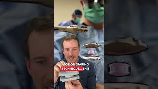 Adjacent Segment Disease & Disc Replacement