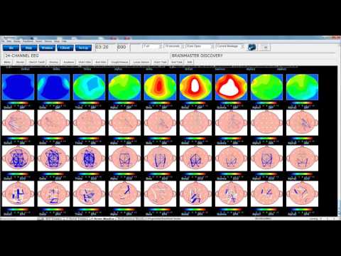 qEEG at Oxford Recovery Center