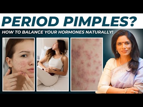 Stop Period Pimples FOREVER! Dr. Smita Naram’s Proven Tips You Need to Know!