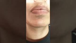 upper lips waxing #likeandsubscribe