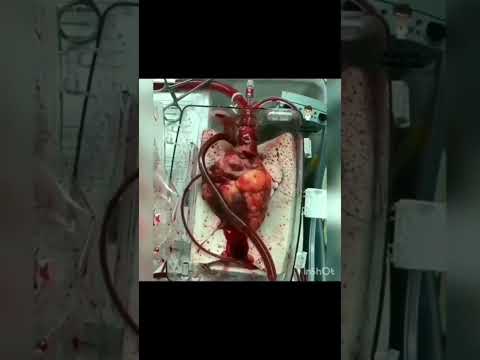 HEART❤#neet2023 #aiimsdelhi #motivation #doctor #neetaspirant #neetstatus #viral