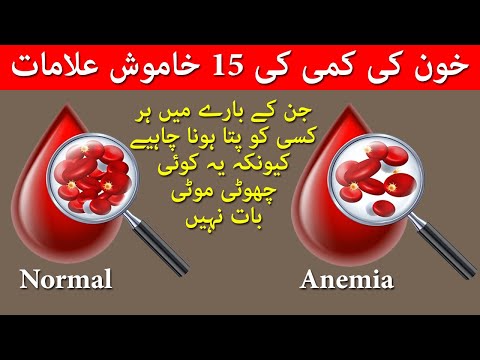 Khoon Ki Kami Ki Alamat | Iron Deficiency Anemia | Khoon Ki Kami Ko Kaise Pura Karen