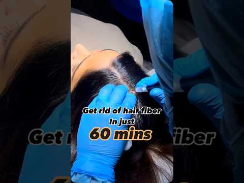 Get Rid of Hair Fibers in Just 60 Minutes! | Scalp Micropigmentation #haircare #shorts