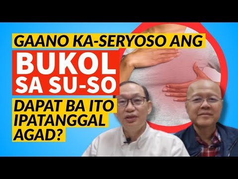 Gaano Ka Seryoso ang Bukol sa Sus-o, Dapat Ba Ipatanggal Agad ang Bukol?