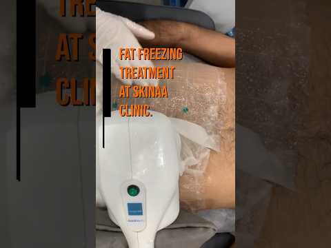 Want to lose some inches? Take Fat Freezing Treatment at Skinaa Clinic #youtube #fatloss #shortvideo