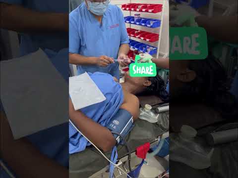 Nasal Intubation with North Pole Tube in Oral Surgery. #viralshorts #anaesthesia #drsumit