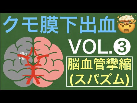 クモ膜下出血❸『スパズム期の管理』