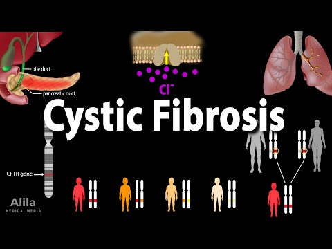 Cystic Fibrosis: Pathophysiology, Genetics, Symptoms, Diagnosis and Treatments, Animation