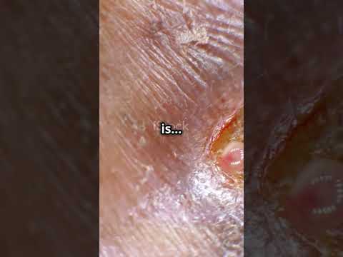 Fact Check: The Fastest Healing Body Part 🩹⚡ #facts #interesting #shorts