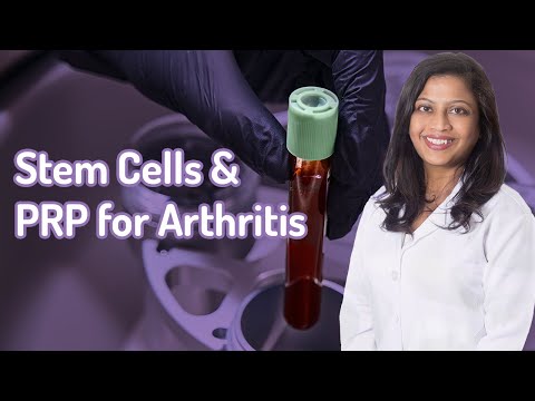 Stem Cells and PRP for Arthritis | A Short Guide to Everything You Need to Know by Dr Humeira Badsha