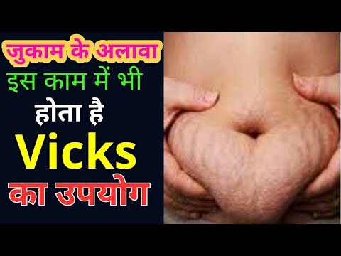 Other Uses of Vicks Veporub/Vicks Veporub के अन्य उपयोग /PNSHealth and beauty