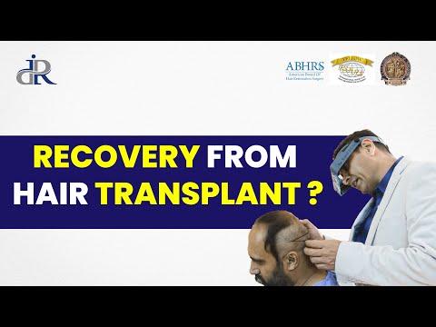 Recovery from Hair Transplant | Dos and Don'ts of Hair Transplant Recovery | Dr Rana Irfan