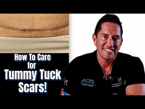 How to Get the Best Tummy Tuck Scars | Dr. Morales Explains