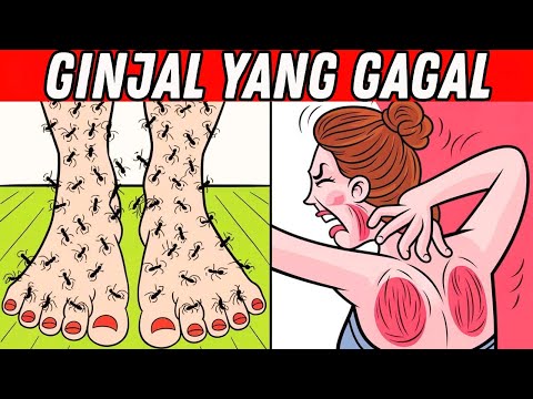 🩺 7 Tanda Aneh Masalah Ginjal 🚨 Nomor 6 Paling Mengejutkan! 😱 | Waspadai Sebelum Terlambat!