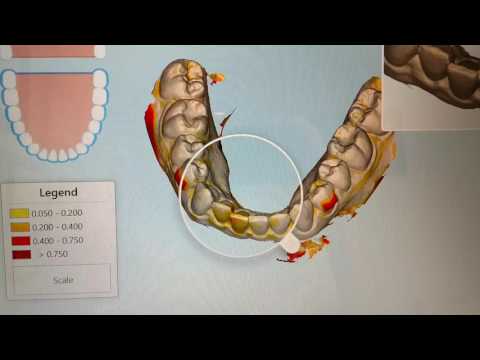 Progress tracking of your treatment